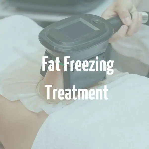 fat freezing treatment Lyndhurst