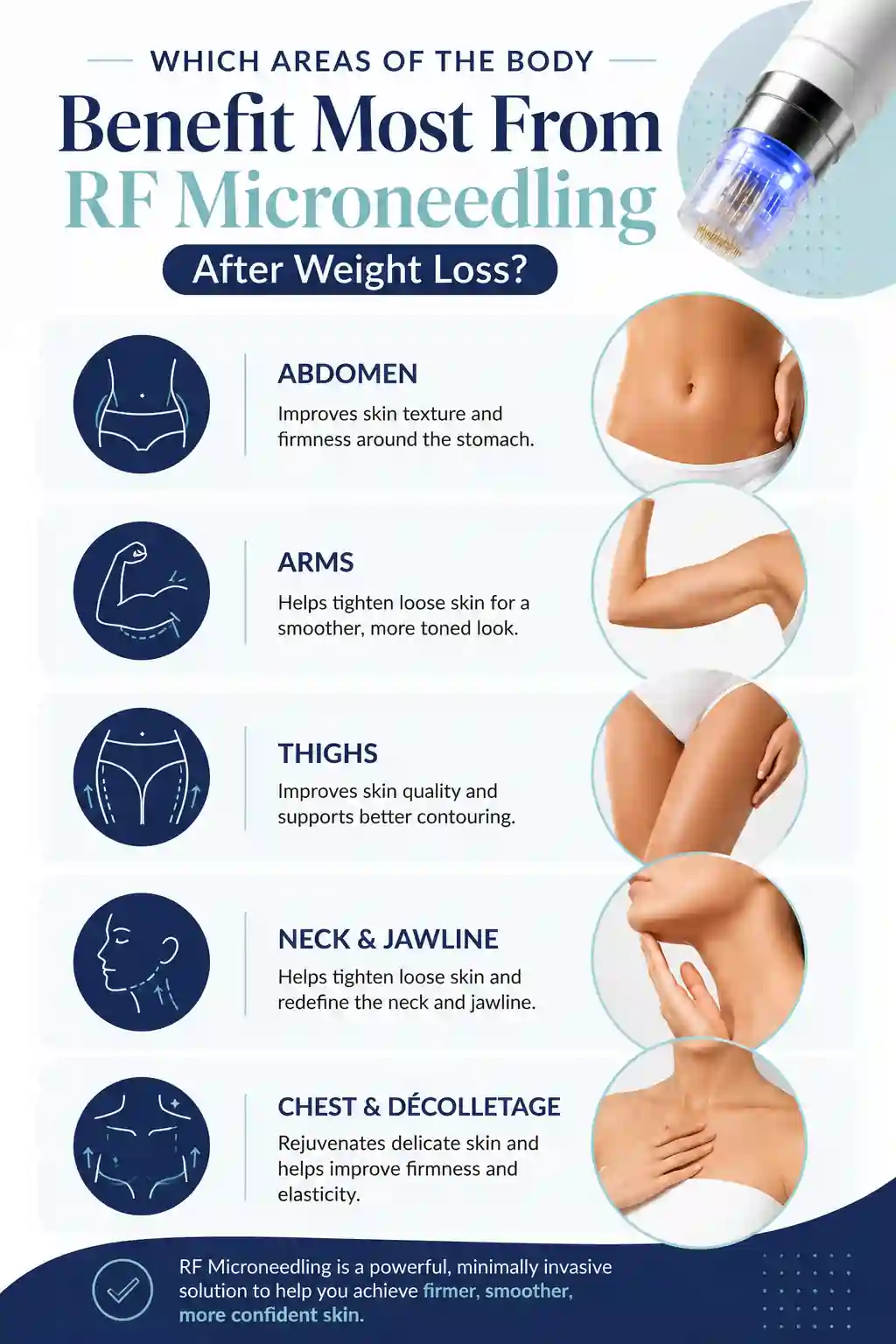 Which Areas of the Body Benefit Most From RF Microneedling After Weight Loss Lyndhurst